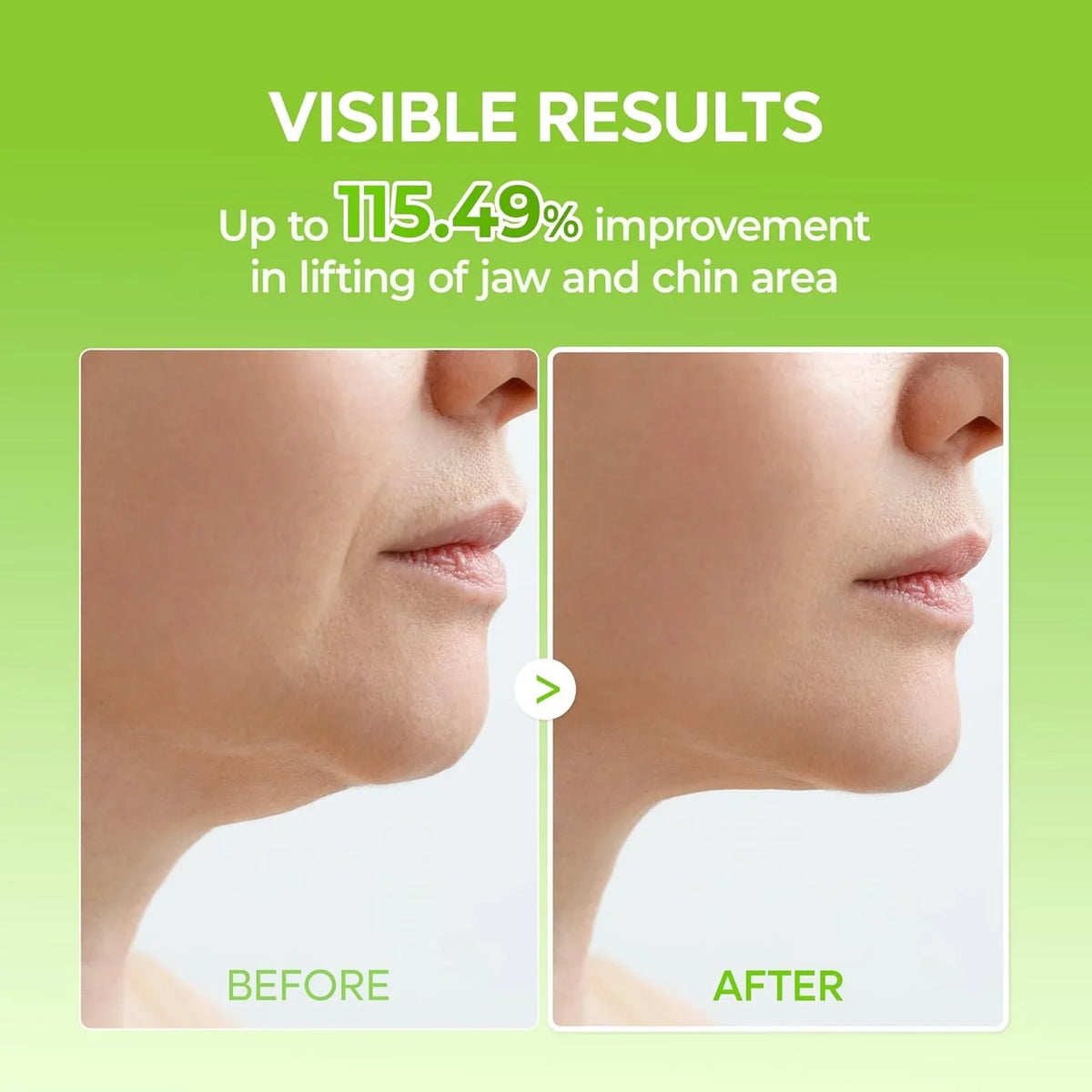 Dr.Melaxin - CACTOX V-Lifting Mewing Band