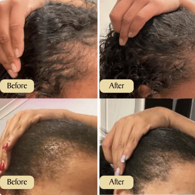 Natural Rosemary Castor Hair Growth Oil