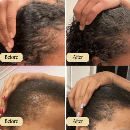 Natural Rosemary Castor Hair Growth Oil