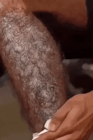 Hair Removal Spray For Smooth Skin