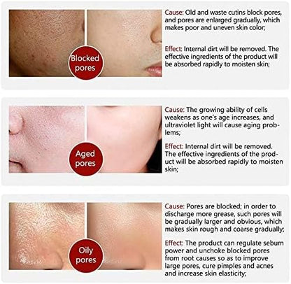 LANBENA - Pore Solution Serum