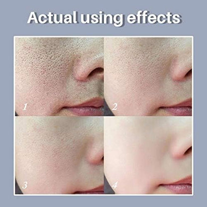 LANBENA - Pore Solution Serum