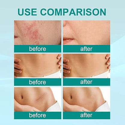 South Moon Scar Care Spray Treatment